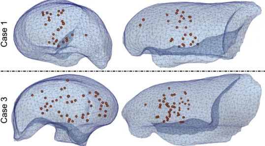 Figure 3.4: Spatial distribution of anatomical landmarks within the lung in the pre- pre-operative configuration.