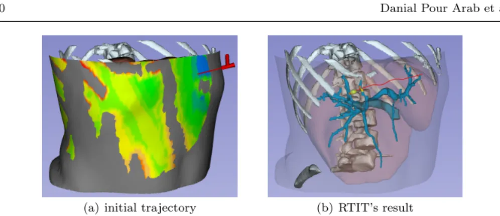 Fig. 5 (a) initial trajectory. (b) RTIT’s result after getting to the target (red). For a good visualization, some models are omitted and the liver and skin models are represented as  semi-transparent.