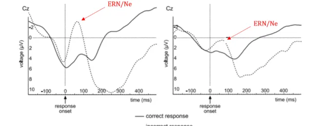 Figure 3.3 – Comparison of the ERN/Ne component in incorrect and in correct trials at the Cz electrode between control (left panel) and borderline personality disorder (right panel) groups