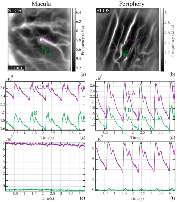 Fig. 6. Laser Doppler measurements in choroidal arteries in the macular and peripheral regions