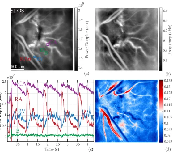 Fig. 7. Pulsatile flow in the retina and choroid. (a) Power Doppler image M 0 ( x, y) indicating the ROIs; the red, blue, green, purple boxes mark a retinal artery and vein, the background, and a choroidal artery, respectively