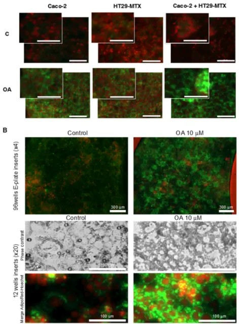 Figure 6. Morphological changes in lipid storage in Caco-2, HT29-MTX cells, and co-cultures