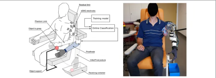 FIGURE 1 | (Left) Global view of the experimental setup during one of the functional tasks of grasping an object (here the foam tennis ball) and releasing it in the dedicated container, with the arm prosthesis controlled through the associated mobilization