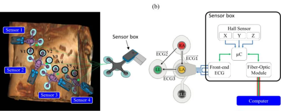 Figure  1.  (a)  Positioning  of  the  MR-compatible  ECG  sensor  network  on  the  volunteer  (the  conventional  precordial  electrodes  V1  to  V6  are  highlighted)  and  schema  of  an  ECG  sensor  including  the  optical  fiber  transmission module