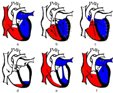 Fig. 1.8 – Activit´e m´ecanique cardiaque