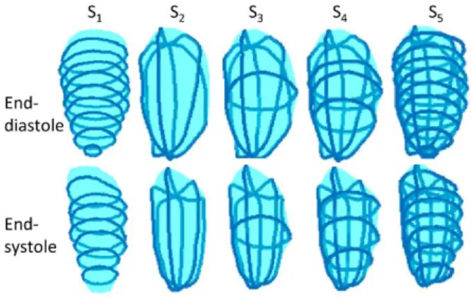 Figure 2 Illustration of the five sparse segmentation strategies for left  ventricular cavity surface reconstruction 