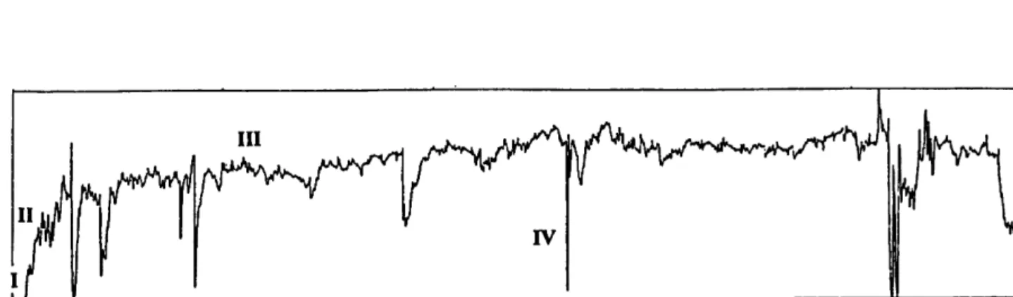 Figure II.6. : Exemple  d'enregistrement  de I'activité de filtration normale  de D. polymorpha 8væ precision  des diftrents états du siphon exhalant.