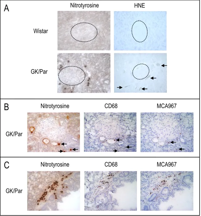 Fig.  1.  In  2.5-month-old  diabetic  GK/Par  pancreases,  nitrotyrosine and  4-hydroxy-2-nonenal  (HNE)-modified  proteins  accumulate  in  the  peri-islet  vascular  and  inflammatory  compartments.