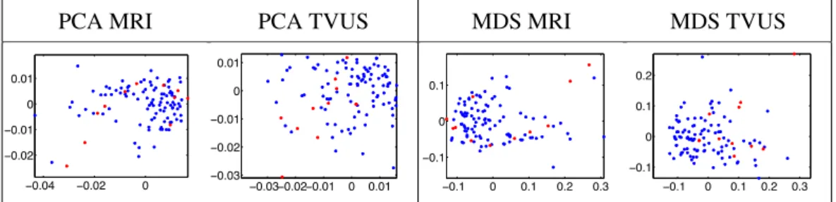 Fig. 6. Principal component analysis (left) and multidimensional scaling (right) based eval- eval-uation of generality and specificity of the proposed shape model for non-deformed (MRI) and deformed (TVUS) endometrial tissue shapes