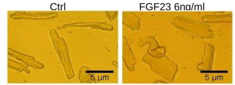 Figure  S2.  FGF23  induces  an  increase  in  cell  surface  area.  A:  Representative  images  of  ARVMs treated for 24h with FGF23 (6 ng/ml) or vehicle (Ctrl)