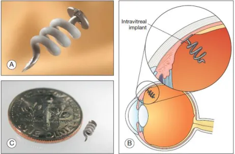 Figure 1.8: I-vation implant. A: structure, B: size, C: implantation. From [141]. 
