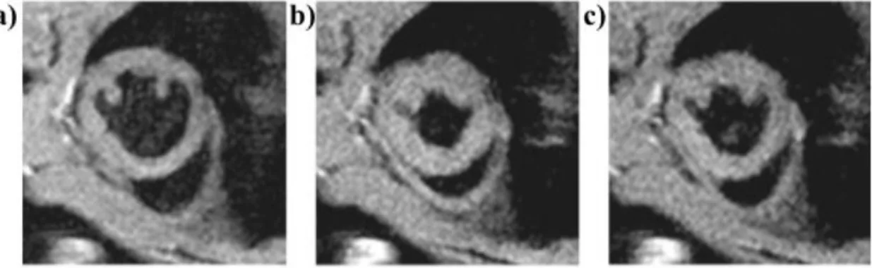 Figure 11 - Images cardiaques de souris réalisées en petit axe avec un contraste sang noir