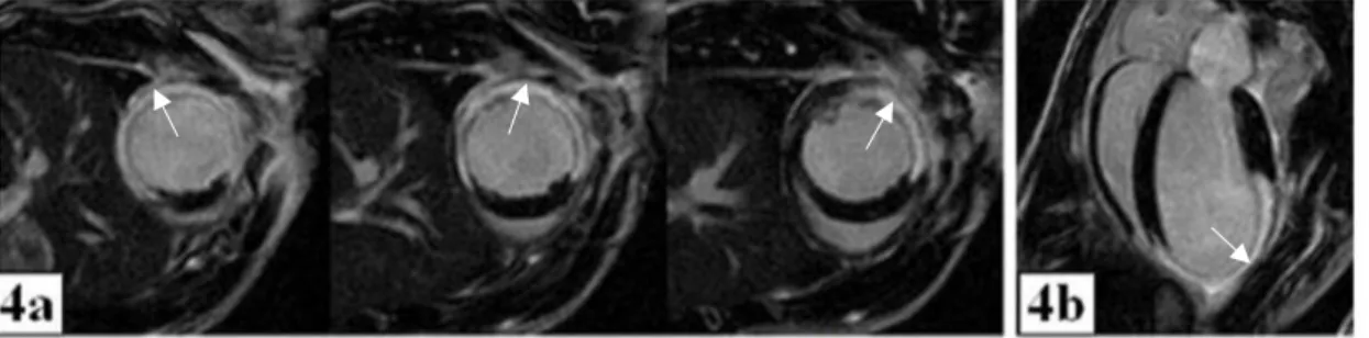Figure 13 - Exemple d'images IRM de premier passage à double contraste accélérées par  CS (Compressed-Sensing) obtenues sur le cœur d’une souris au repos