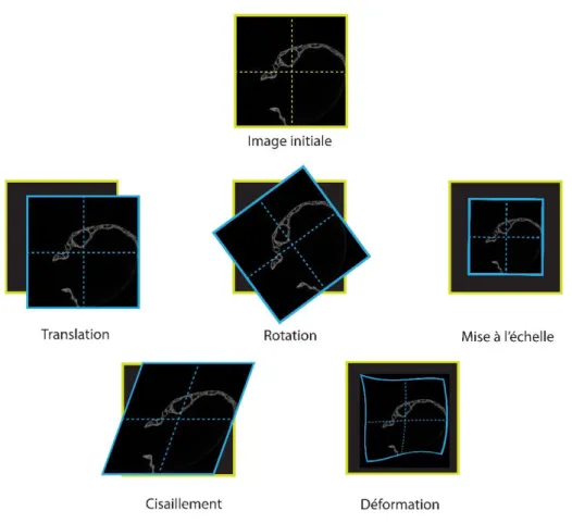 Figure  2.5   Schématisation  des  différentes  modifications  utilisées  dans  les  modèles  de  transformations en segmentation automatique