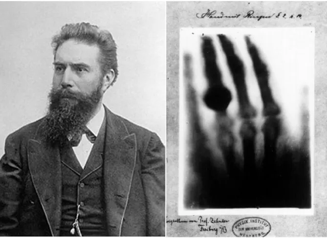 Figure 1.1: Left: picture of W. R¨ ongten. Right: The first medical radiography taken in history by W