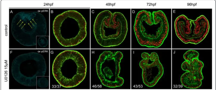 Fig. 2 U0126 blocks ERK activation, endomesoderm formation, and gastrulation. a – e Control embryos