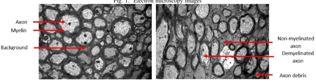 Fig. 1. Electron microscopy images