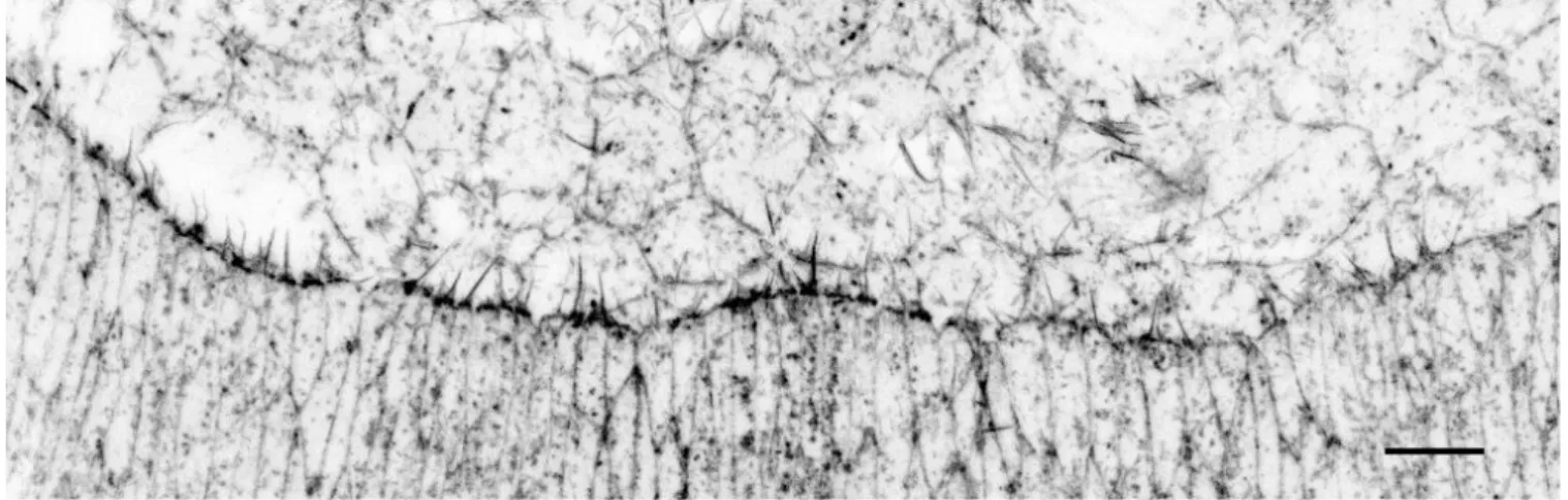 Figure 20. Actin cable during dorsal closure. 