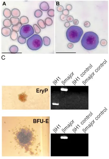 Figure 6: Comparison between primitive and definitive erythropoiesis.   