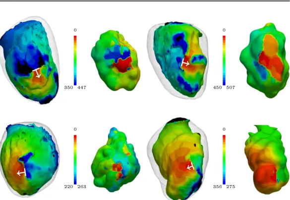 Figure 2.5: Comparison of predicted (left) activation maps (in ms) to ground truth data (right) obtained from VT recording during RF catheter ablation in 4 dierent patients