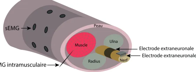 Figure 2.3: Positionnement des diff´ erents types d’interfaces neuronales autour du syst` eme nerveux p´ eriph´ erique