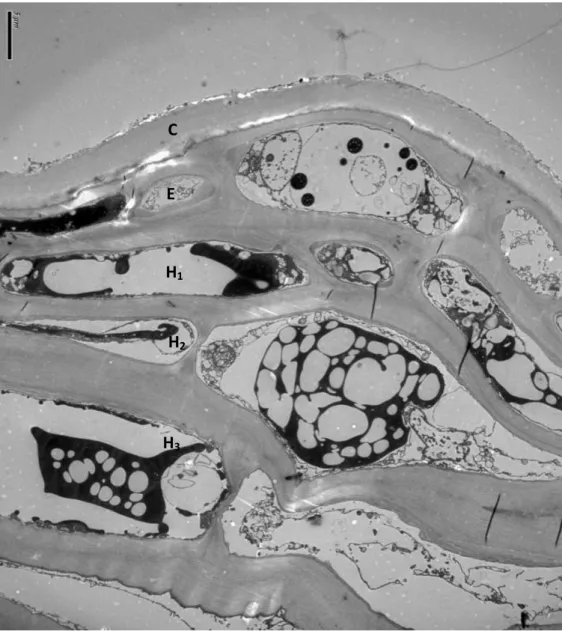 Figure 4 Ultrastructure d’une pellicule de Cabernet sauvignon à maturité par microscopie électronique à  transmission