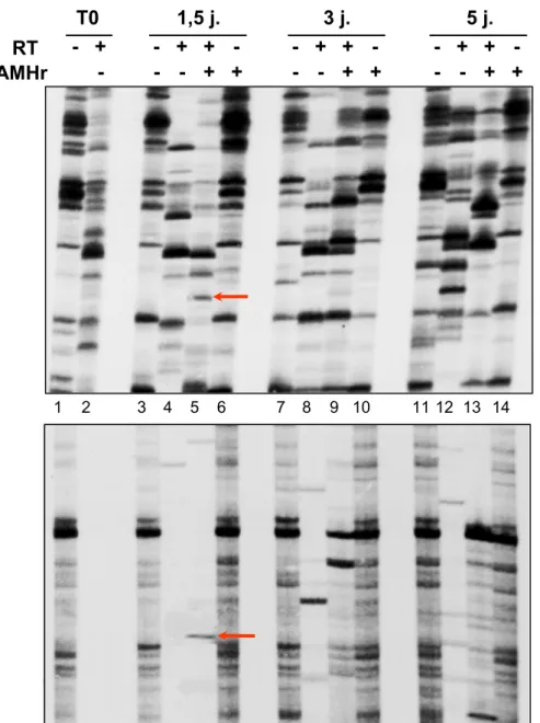 Figure  6.  Révélation  auto-radiographique  après  migration  en  gel  de  polyacrylamide des produits de DDRT-PCR