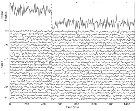 Figure 6.3: Individual EChG traces per trials #201-225 aligned by stimulation event are displayed on the bottom part of the figure