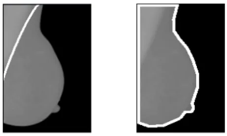 Figure 2 – Exemples de contours actifs basés contours (contour  ouvert à gauche ou fermé à droite) 