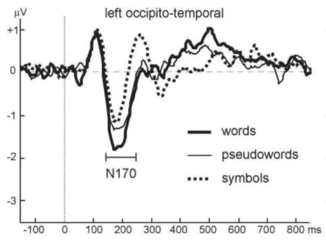 Figure 9 : Modulation de l’amplitude de la N170 enregistrée au  niveau de PO7 en  fonction du  matériel verbal  présenté