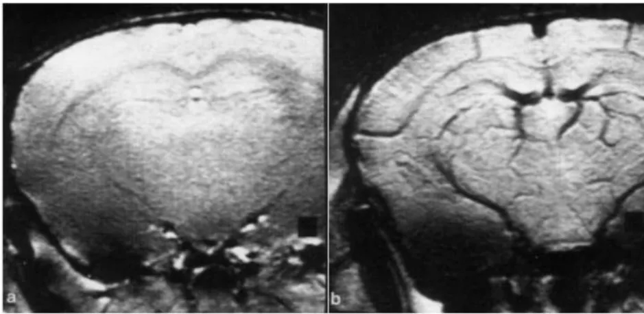 Fig. 2.1  Images pondérées en T 2 ∗ d'un erveau de rat. (a) L'animal respire de l'oxygène