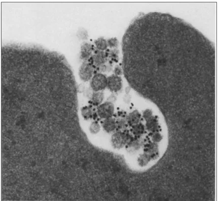 Figure 6 Libération d’exosomes par des réticulocytes en maturation. Après 18h d’incubation en présence d’un anticorps  anti-récepteur à la transferrine, le marquage à l’or colloïdal est localisé à la membrane des vésicules intraluminales du MVE