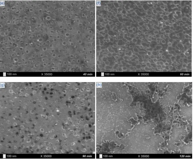Fig. 8. SEM pictures of Ta layers galvanostatically electrodeposited on Nitinol plates at -100  µA/cm², 25°C and during 10 min (a), 15 min (b), 20 min (c), 30 min (d), 40 min (e), 60 min (f), 