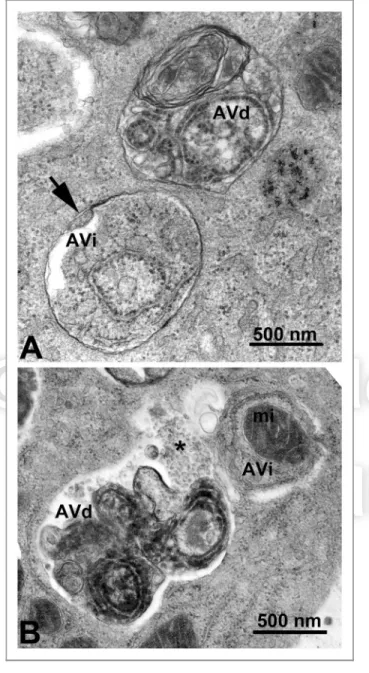Figure 2. TEM images of autophagic vacuoles in isolated mouse hepatocytes. (A) One autophagosome or early autophagic vacuole (AVi) and one degradative autophagic vacuole (AVd) are shown