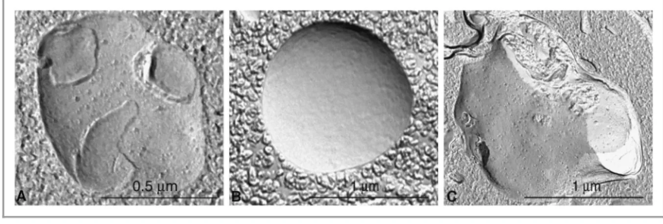 Figure 3. Different autophagic vesicles observed after freeze fracturing in cultured osteosarcoma cells after treatment with the autophagy inducer voacamine