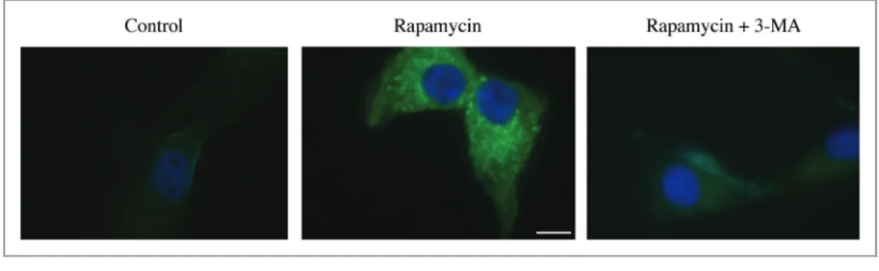 Figure 9. Changes in the detection and localization of GFP-LC3 upon the induction of autophagy