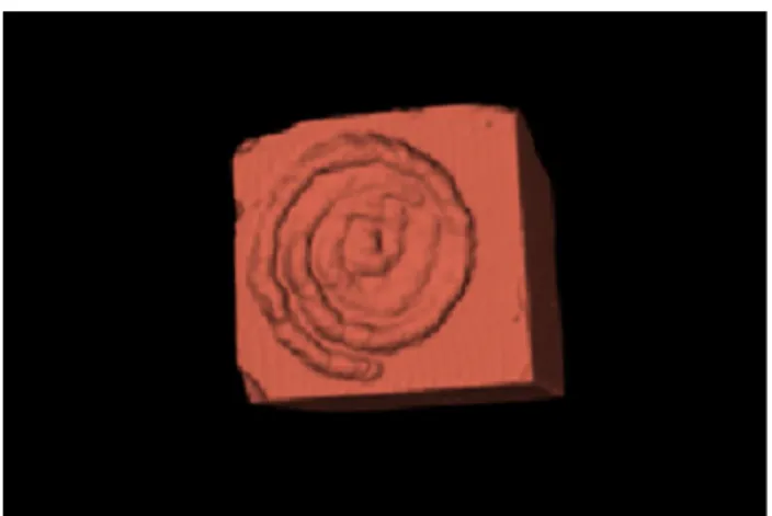 Fig. 2    Method of segmentation using 3D Slicer to assess ablation  volumes based on DICOMs’ non-enhanced CT scan