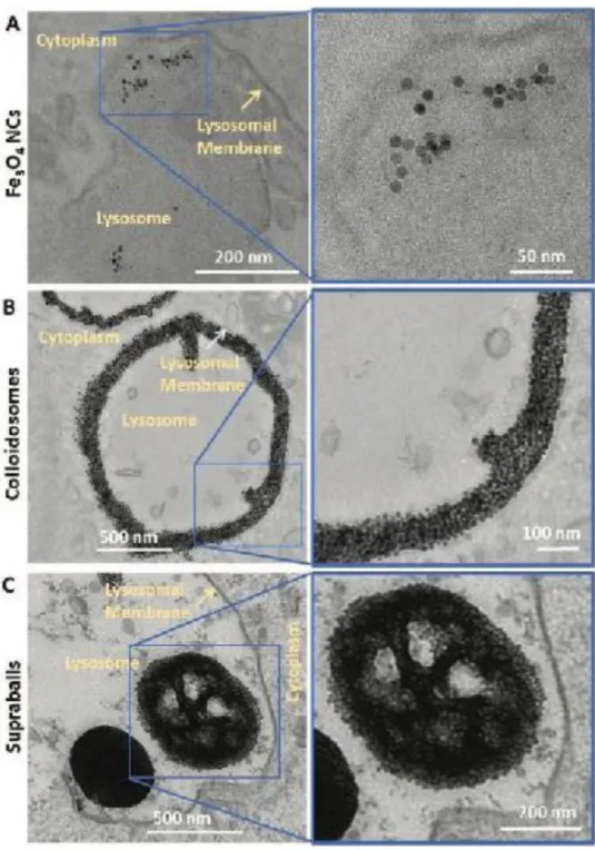 Figure 4. Colloidosome and supraball intracellular distribution in A431 cells. TEM images of A) Fe 3 O 4  NC, B) colloidosome and C)  supraball-loaded cells 24 h after incubation illustrating the distinct intralysosomal distribution of nanocrystals