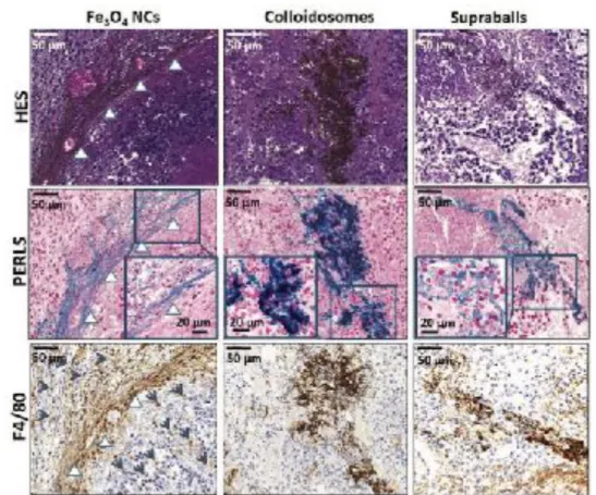 Figure 6. Histological (Perls and HES staining) and immunological (F4/80 labeling) analysis of MET-1 tumors 24 h after intratumoral  injection of Fe 3 O 4  NCs, colloidosomes and supraballs
