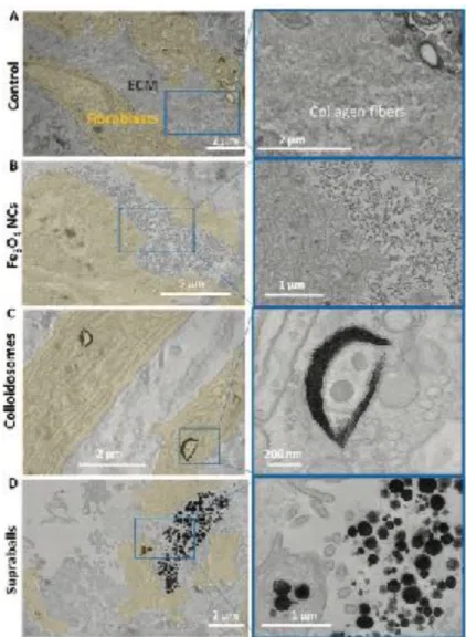 Figure 8. TEM images on 70 nm microtome sections of Fe 3 O 4  NCs, colloidosome or supraballs distribution in the fibroblast/ECM in vitro  model