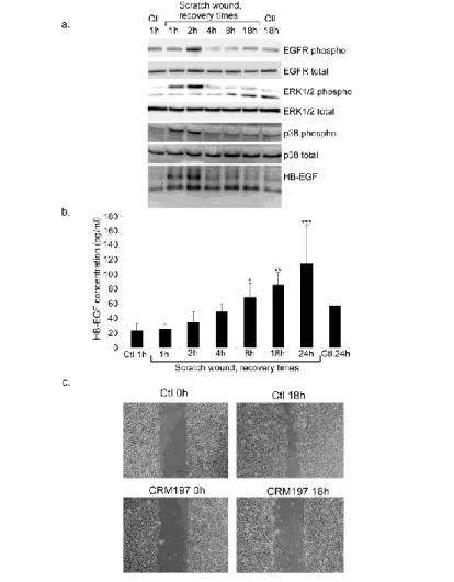 Figure  2:  HB-EGF  is  synthesized  and  released  after  scratch  wound  in  human  keratinocytes  cultures