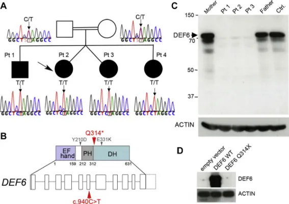 FIG 1. Identification of a homozygous nonsense mutation in DEF6 in 4 siblings with autoimmunity, inflam- inflam-mation, chronic EBV viremia, and EBV-driven lymphoproliferations