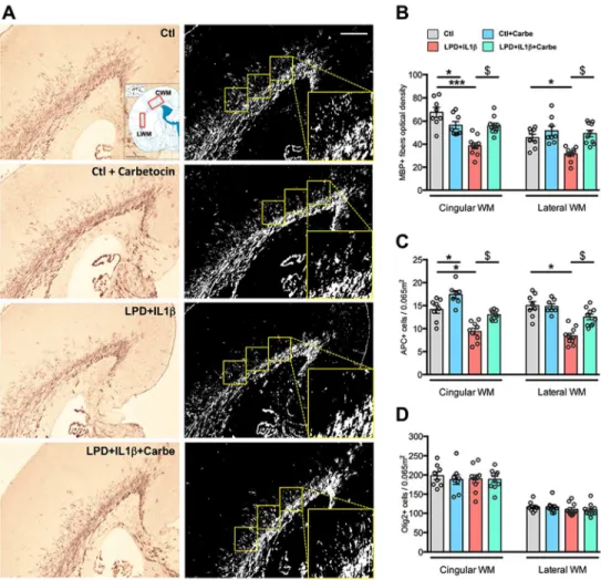 Figure 5: Consequences of LPD+IL1β and carbetocin treatment on myelination.  