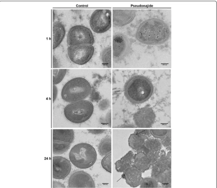 Fig. 7 Transmission electron microscopy images of Staphylococcus epidermidis in the presence or absence of pseudonajide