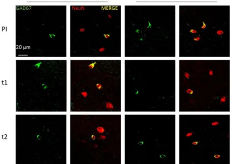 Figure 3.  Effects of EGCG treatment on GAD67 neurons during development of Dp16(1)Yey mice