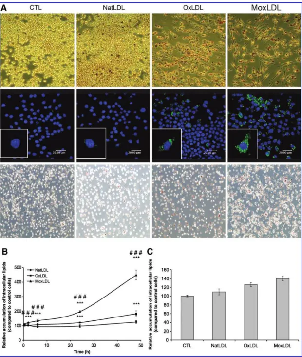 FIG. 1. Differential lipid accumulation in macrophages incubated with OxLDLs or MoxLDLs