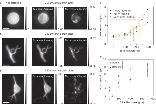 Figure 3 | Shape propagation through brain slices. a, Two-photon  ﬂuorescence x–y  cross-sections of a 15  mm GPC-generated spot after propagation through  250  mm of ﬁxed cortical brain slices (l  ¼  800 nm)