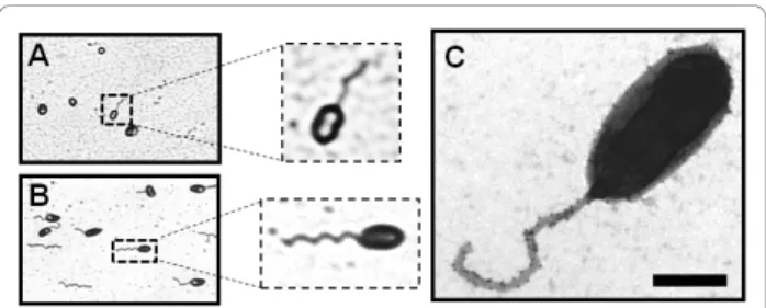 Figure 1 Visualization of flagella. Ryu staining of B. melitensis (A) C. crescentus (B) observed by phase-contrast microscopy