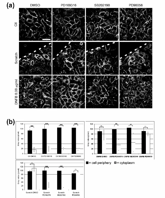 Figure 2: EGFR internalization depends on p38 MAPK activation in stress situation 