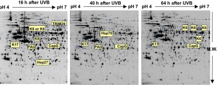 Figure 1. Representative 2D-DIGE profiling of N-hTERT keratinocytes repeatedly exposed to UVB and remarkable differential spots intensities